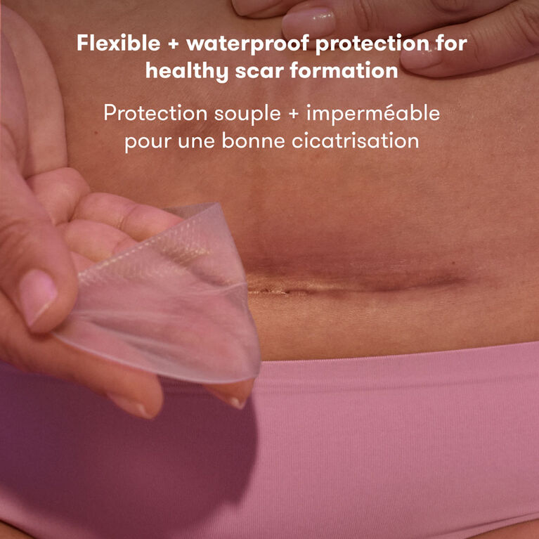 Frida Mom CSection Scar Patches Babies R Us Canada