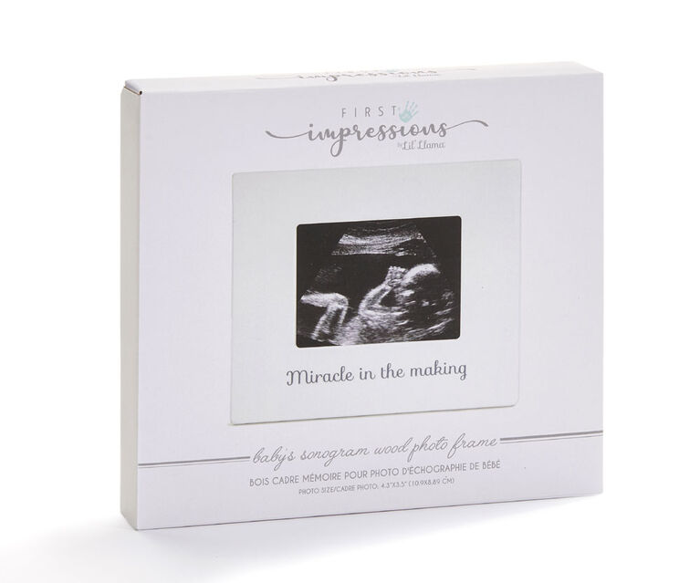 Sonogram Frame Miracle In Making