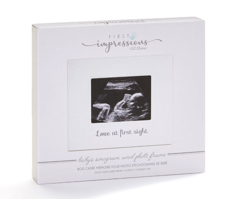 Sonogram Frame Love At First Sight