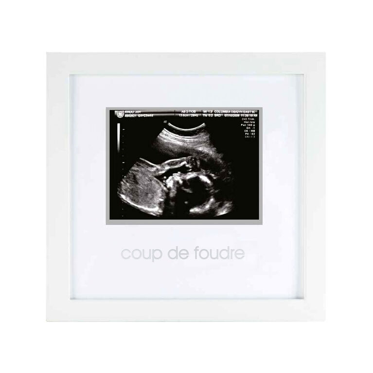 Pearhead Sonogram Frame - French Edition